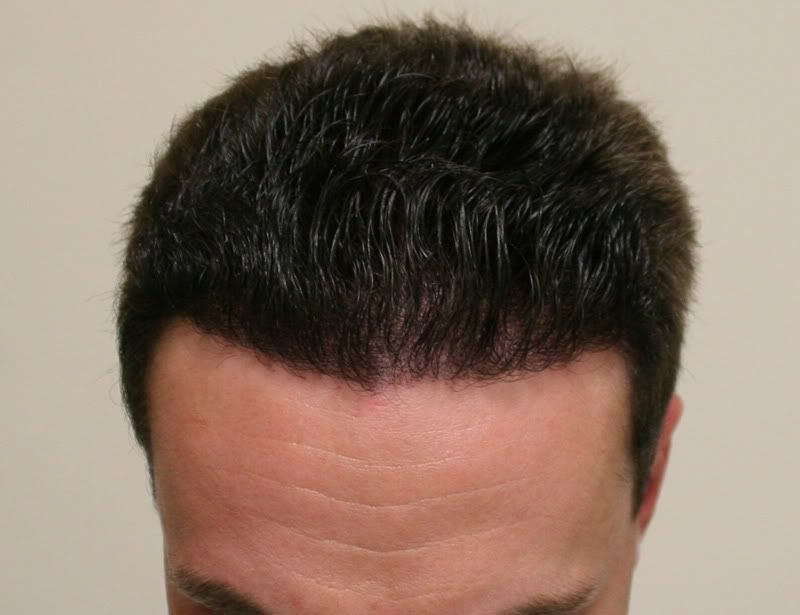 La maschera con gelatina per capelli per rivolgersi a radici di capelli